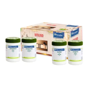 Vitiligo Root Cause Treatment